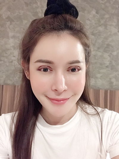แก้ตาสองชั้น ดึงกล้ามเนื้อตา เปิดหางตา