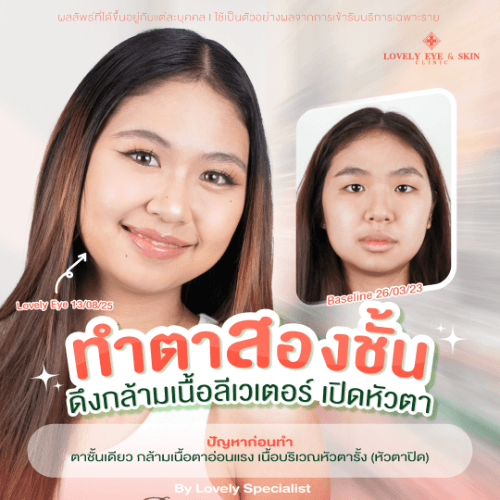 คุณปาล์ม