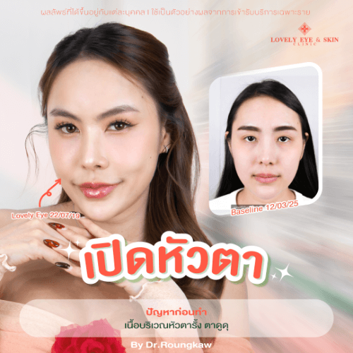 คุณมล