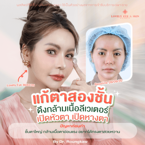 คุณหนูแนน