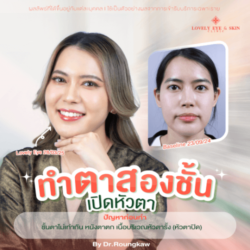 คุณเอิง