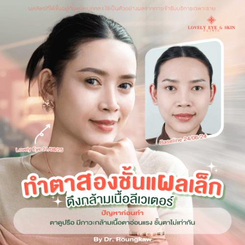 คุณโย