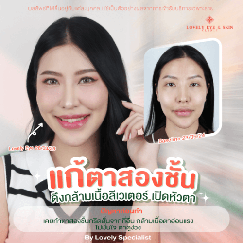 คุณไนซ์