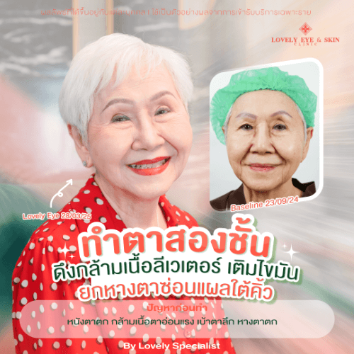 อาม่าแต๋ว