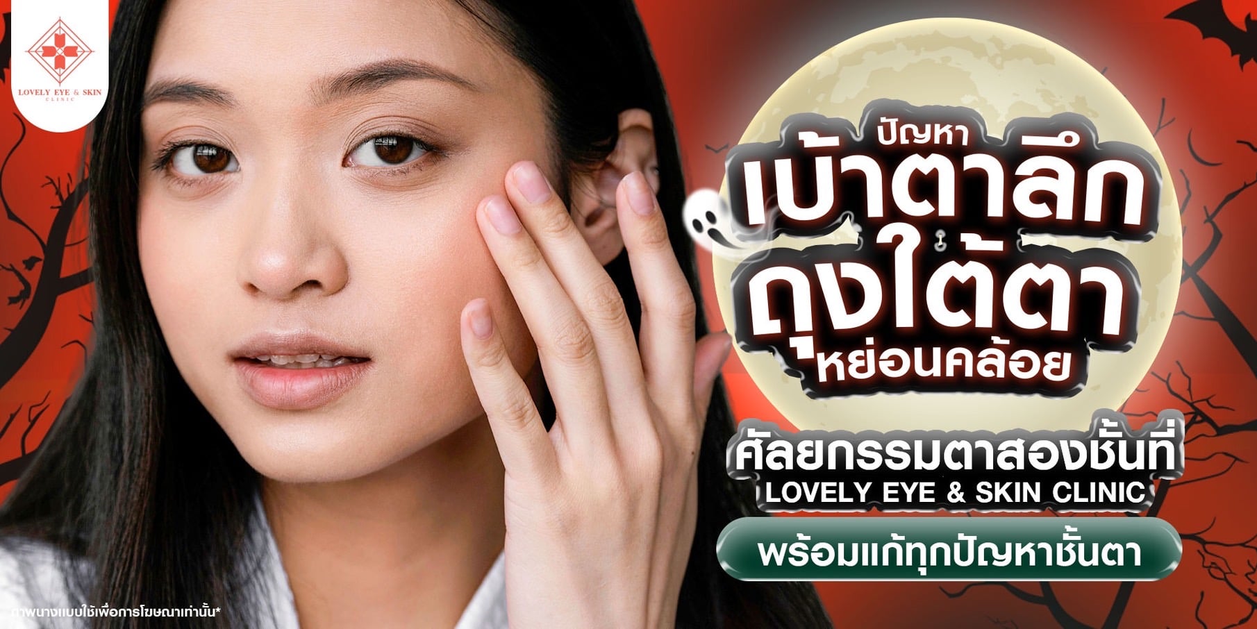 ปัญหาถุงใต้ตา ติดต่อ Lovely Eye Clinic