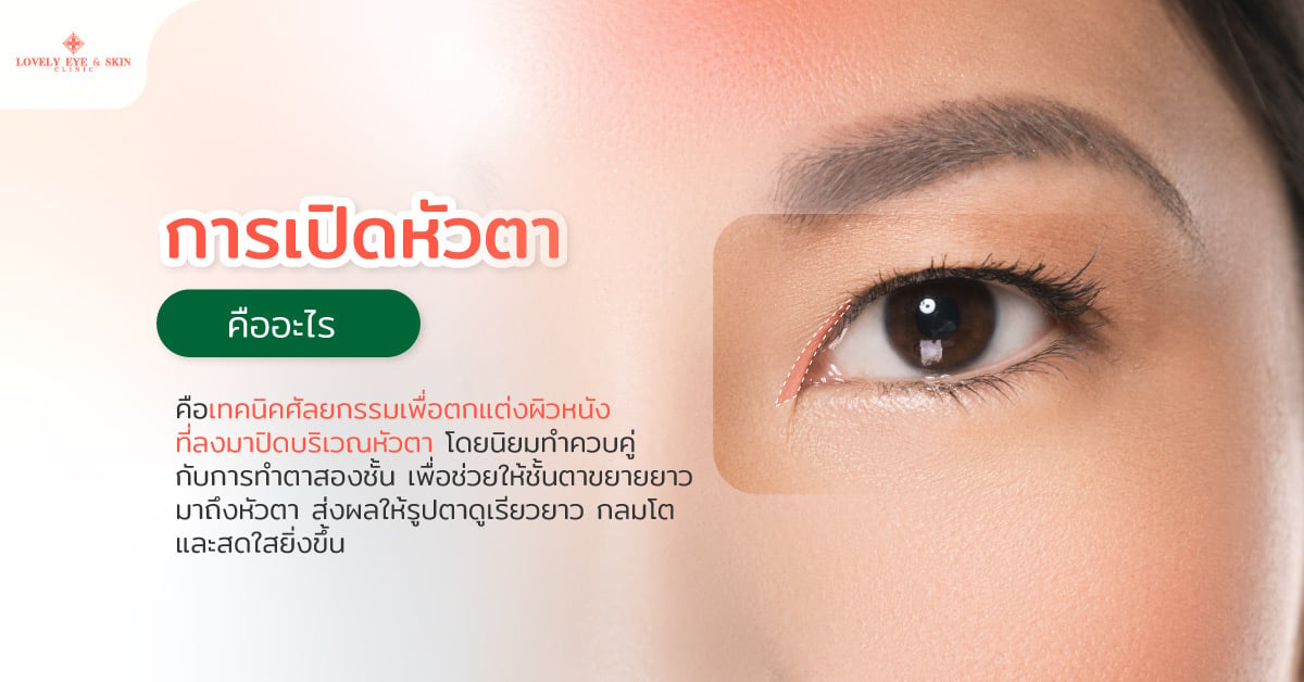 การเปิดหัวตา คืออะไร