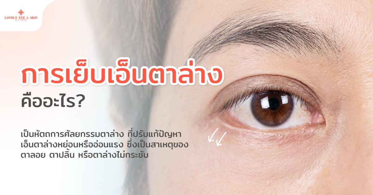 การเย็บเอ็นตาล่าง คืออะไร?
