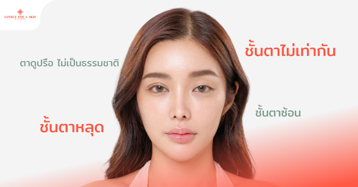 สาเหตุที่ควรแก้ตาสองชั้น