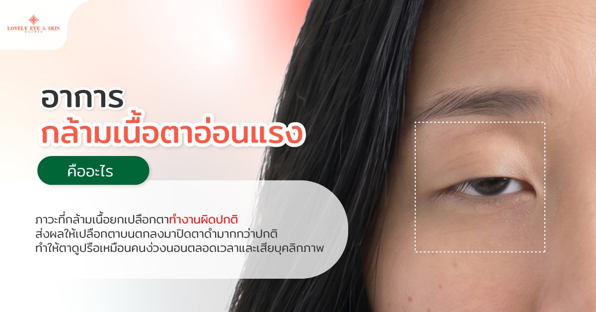 อาการกล้ามเนื้อตาอ่อนแรง คืออะไร