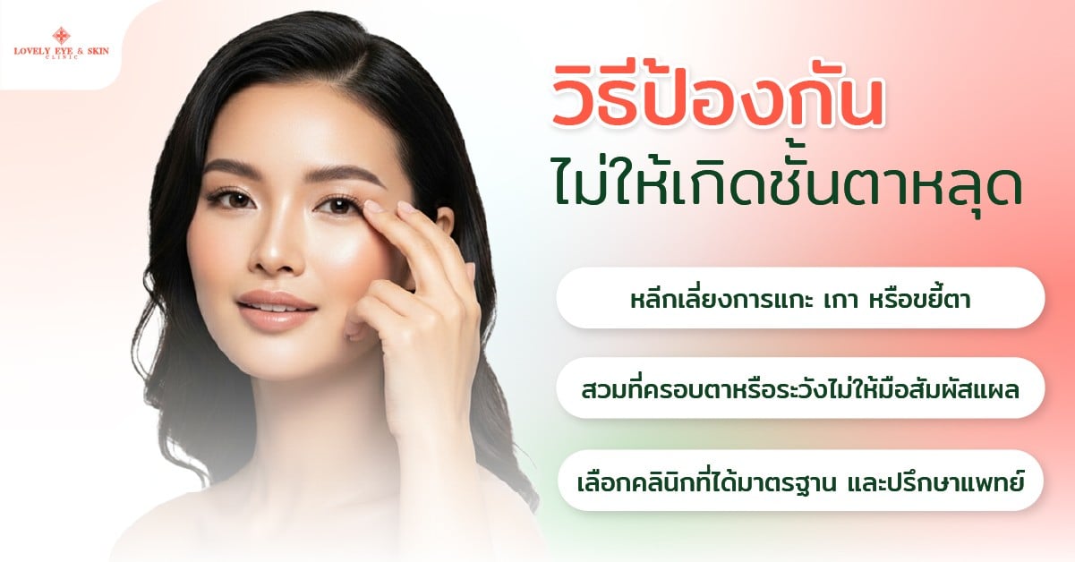 วิธีป้องกันไม่ให้เกิดชั้นตาหลุด
