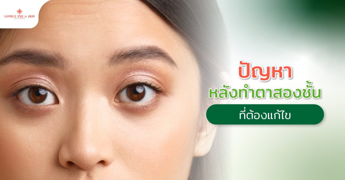 ปัญหาหลังทำตาสองชั้นที่ต้องแก้ไข