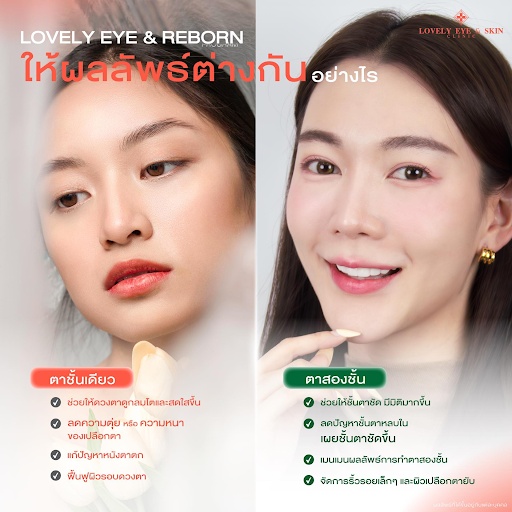 รีวิว Thermage Eye ด้วยโปรแกรม Lovely Eye Reborn ที่ Lovely Eye & Skin Clinic