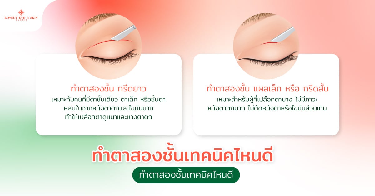 ทำตาสองชั้นเทคนิคไหนดี เลือกให้เหมาะกับดวงตา