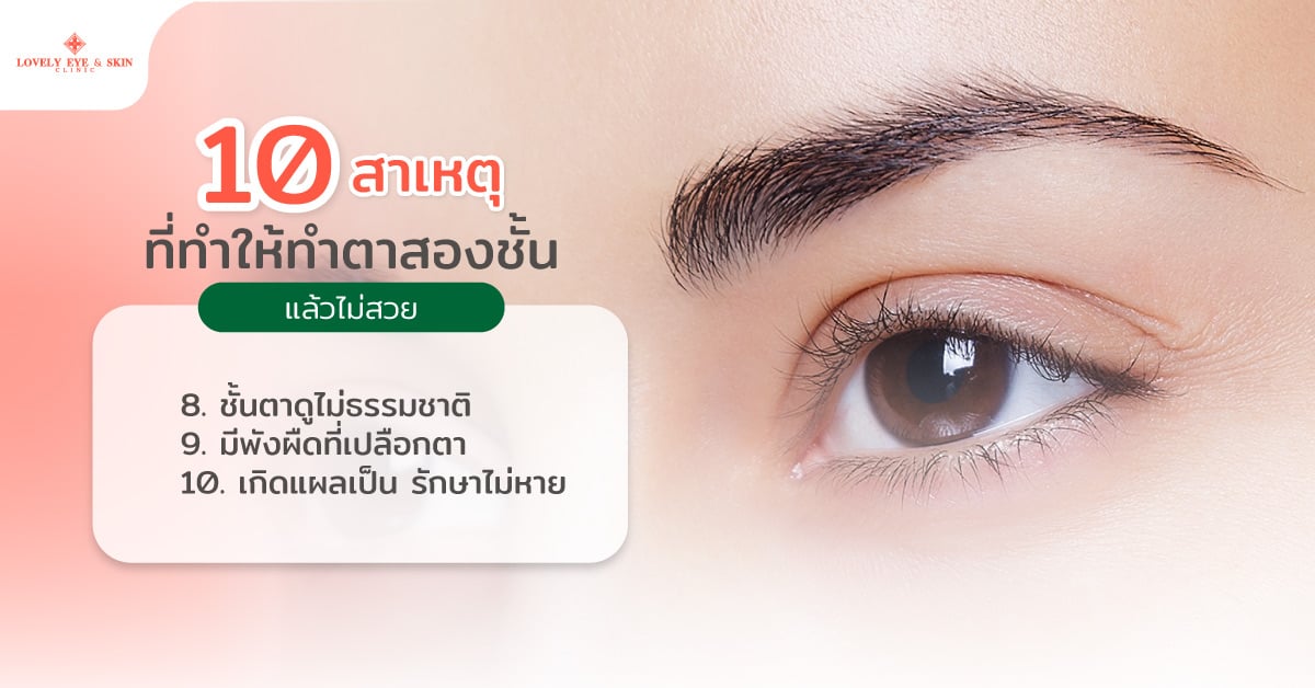 8. ชั้นตาดูไม่ธรรมชาติ