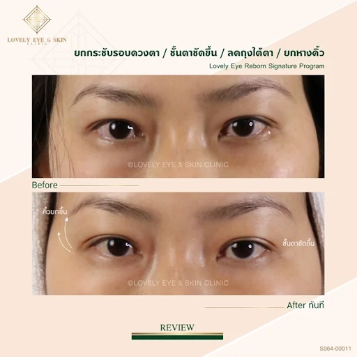 เลือกชั้นวางของติดผนังหลากหลายสไตล์ ช่วยเพิ่มพื้นที่จัดเก็บและตกแต่งบ้านให้เป็นระเบียบมากยิ่งขึ้น