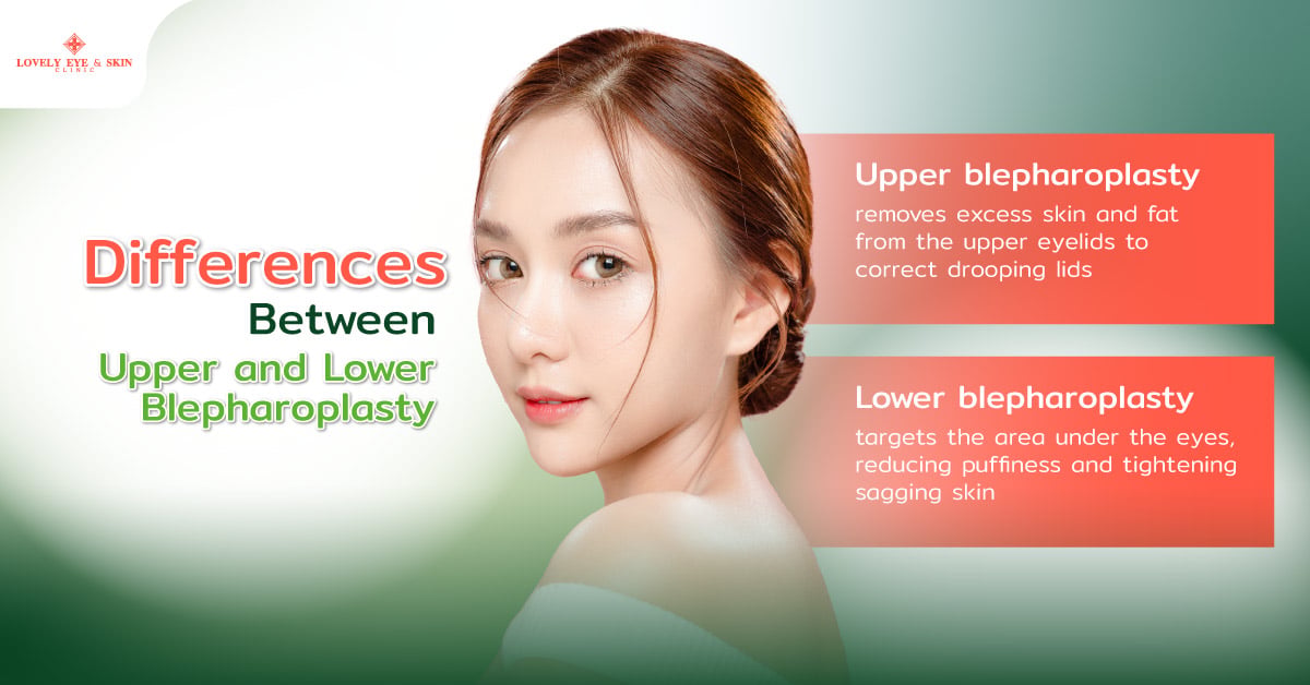 Differences Between Upper and Lower Blepharoplasty
