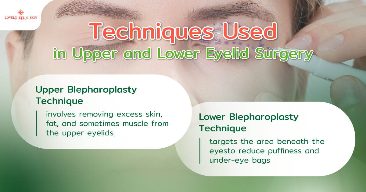 Techniques Used in Upper and Lower Eyelid Surgery