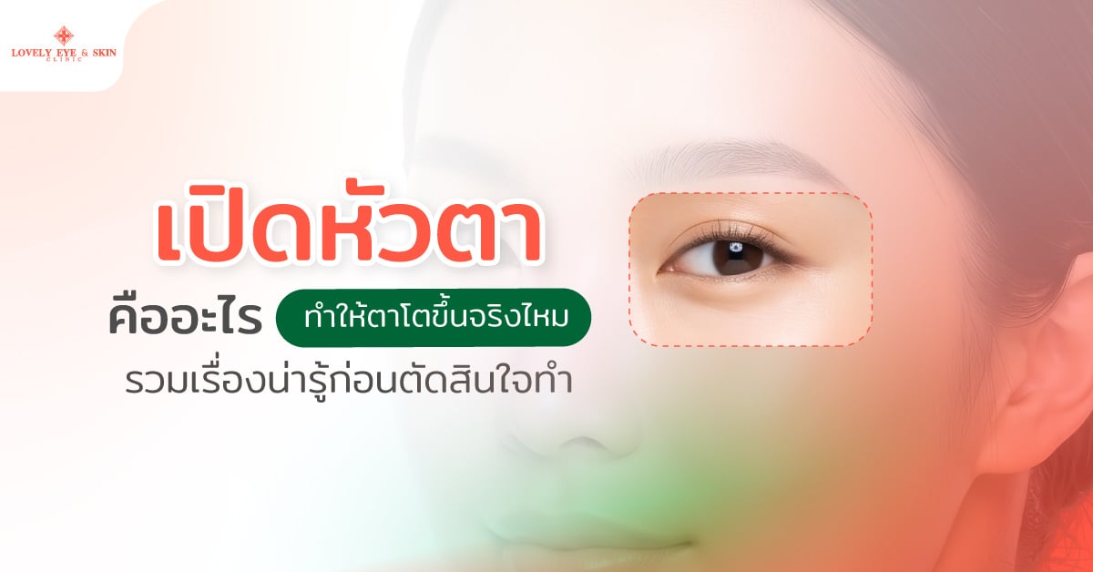 เปิดหัวตาคืออะไร ทำให้ตาโตขึ้นจริงไหม รวมเรื่องน่ารู้ก่อนตัดสินใจทำ