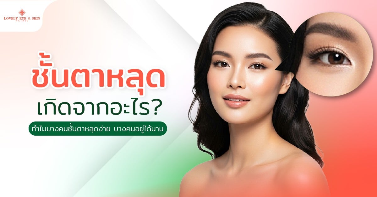 ชั้นตาหลุดเกิดจากอะไร? ทำไมบางคนชั้นตาหลุดง่าย บางคนอยู่ได้นาน