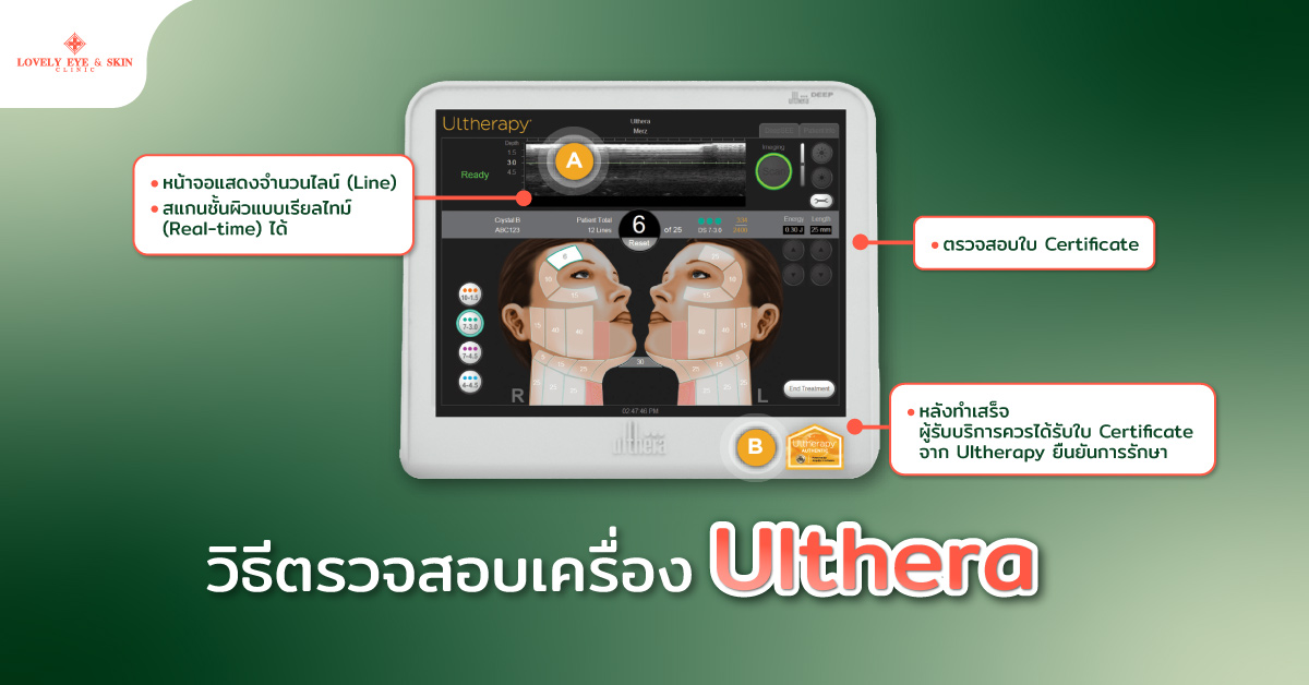 วิธีตรวจสอบเครื่อง Ulthera