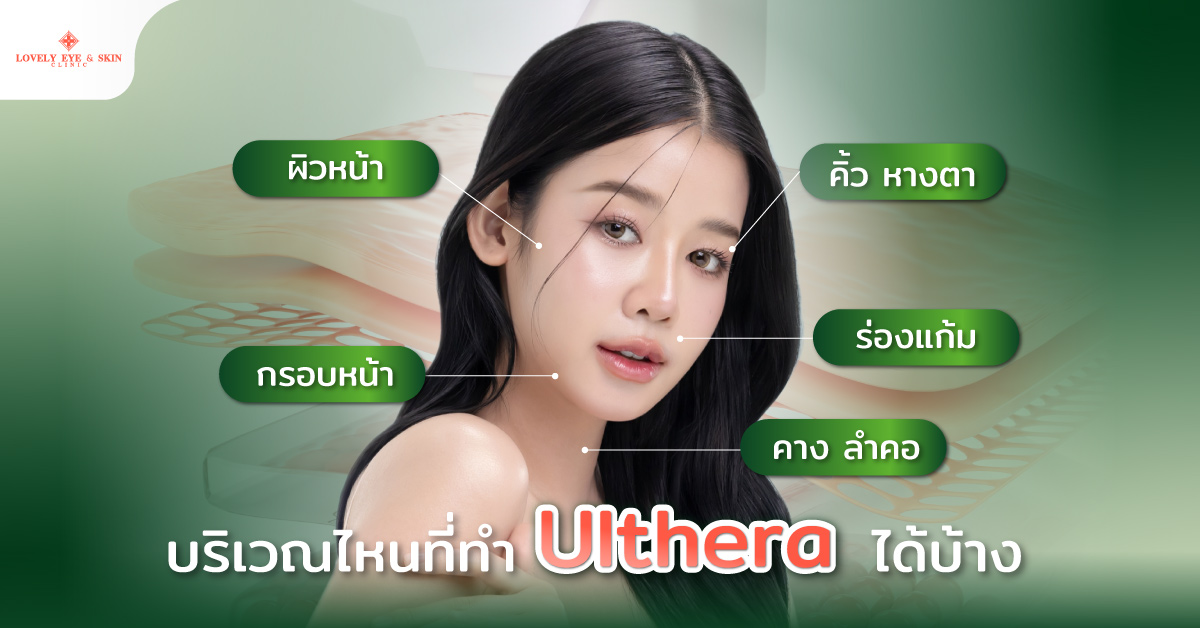 บริเวณไหนที่ทำ Ulthera ได้บ้าง