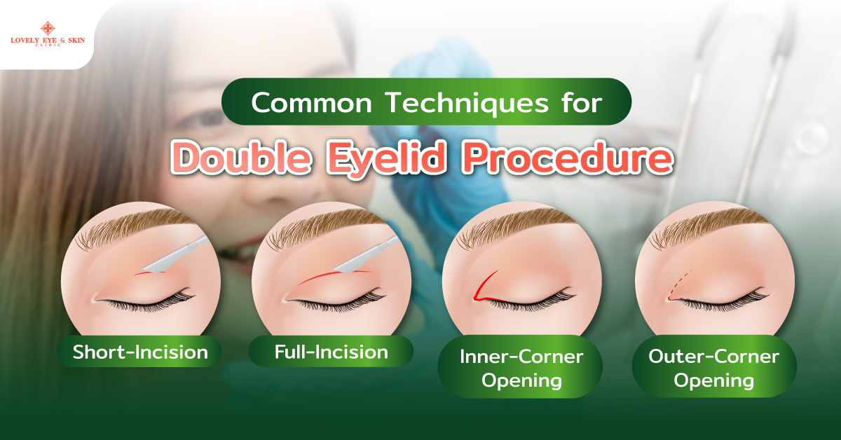 Common Techniques for Double Eyelid Procedure at Lovely Eye Clinic