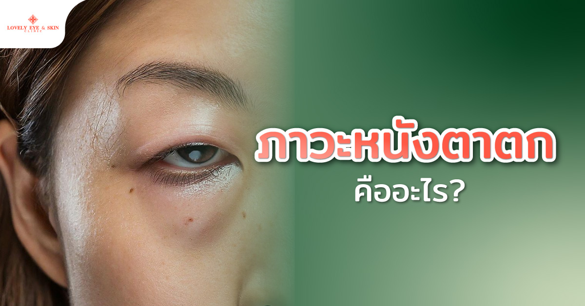 ภาวะหนังตาตกคืออะไร?