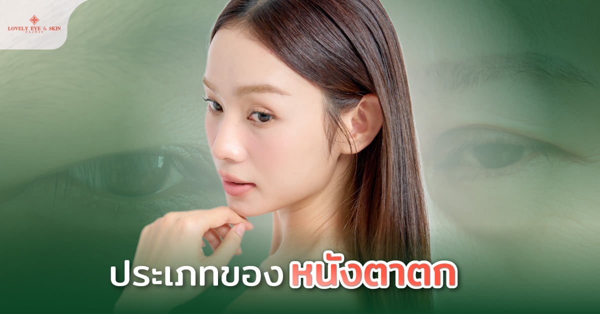 ประเภทของหนังตาตก