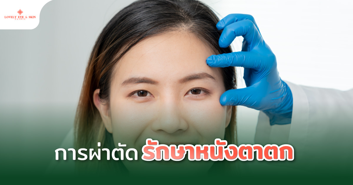 การผ่าตัดรักษาหนังตาตก