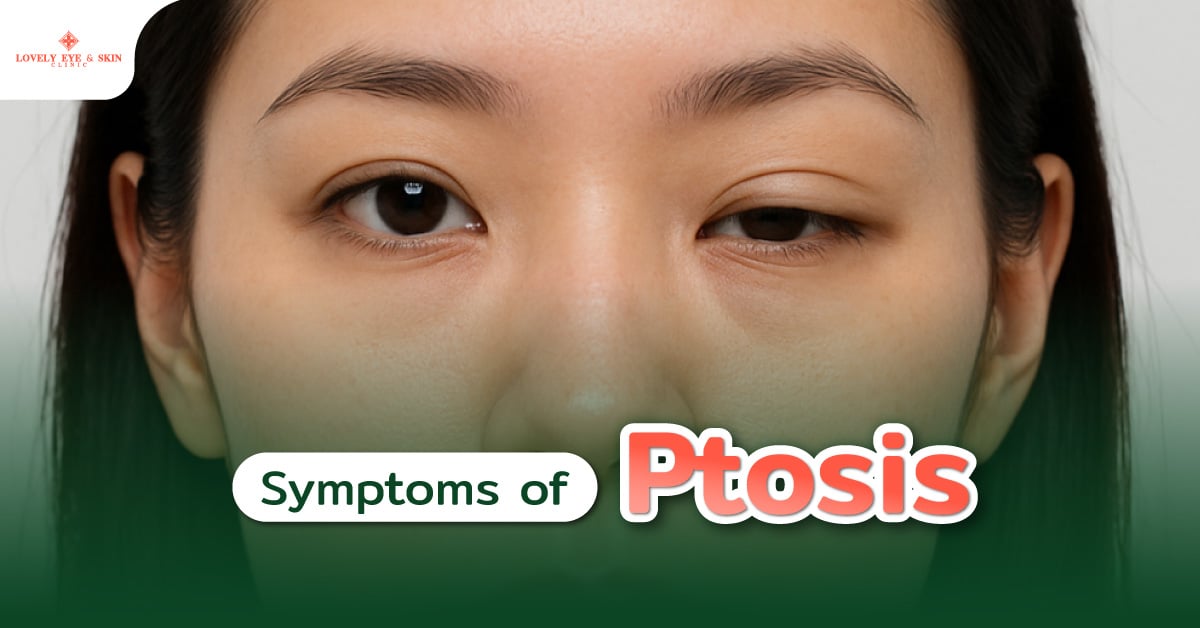 Symptoms of Ptosis