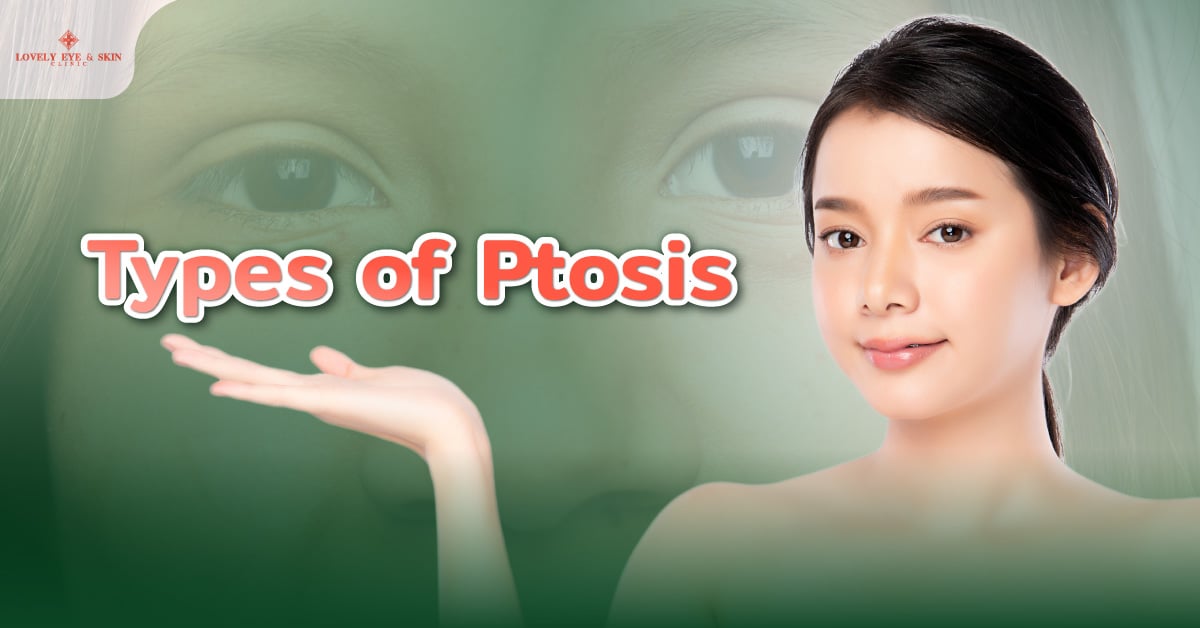Types of Ptosis