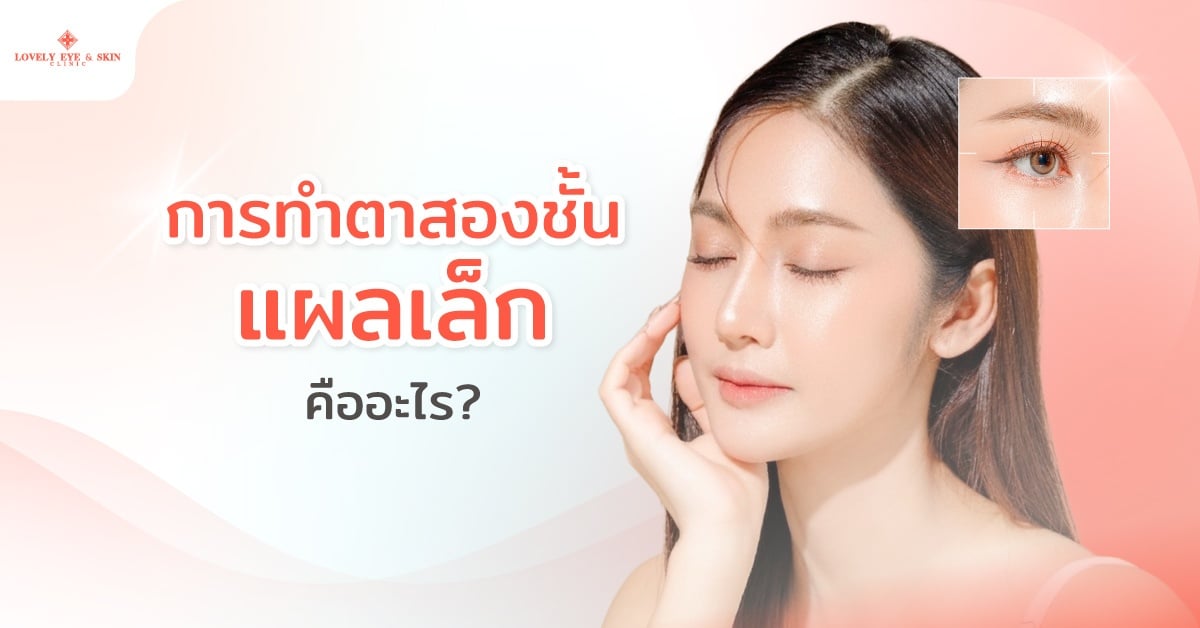 การทำตาสองชั้นแผลเล็ก คืออะไร
