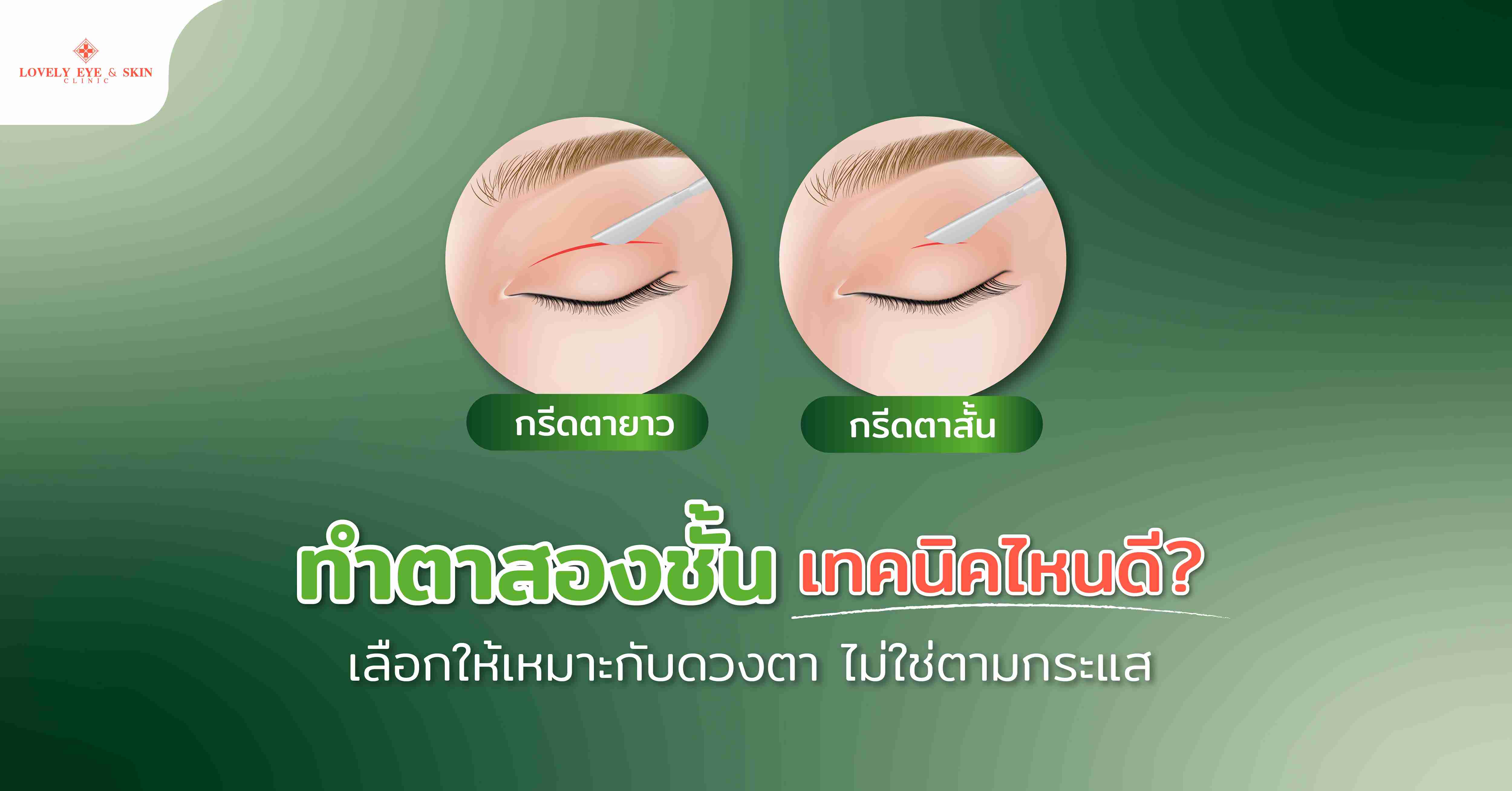 ทำตาสองชั้นเทคนิคไหนดี? เลือกให้เหมาะกับดวงตา ไม่ใช่ตามกระแส