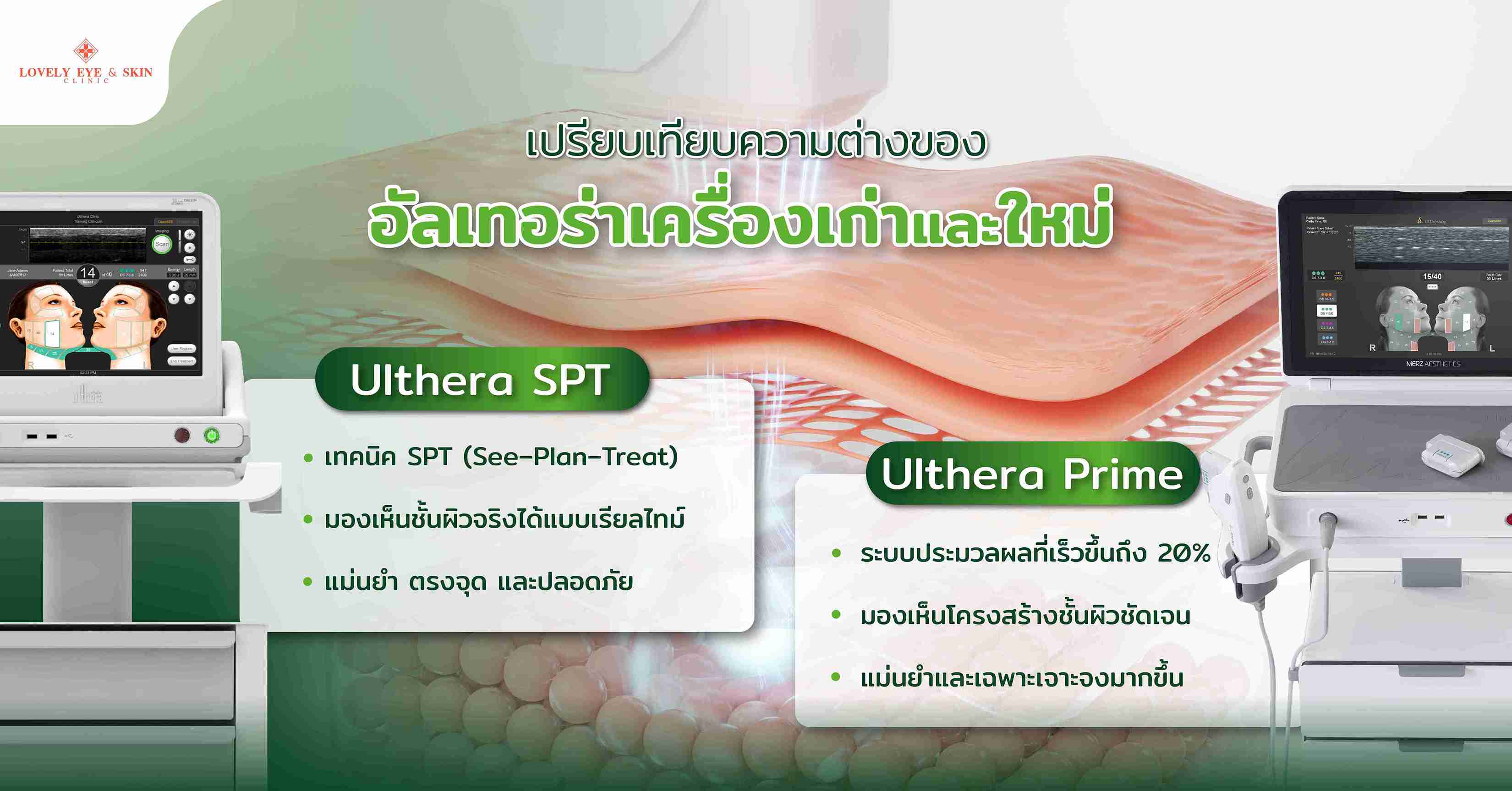 เปรียบเทียบความต่างของอัลเทอร่าเครื่องเก่าและใหม่