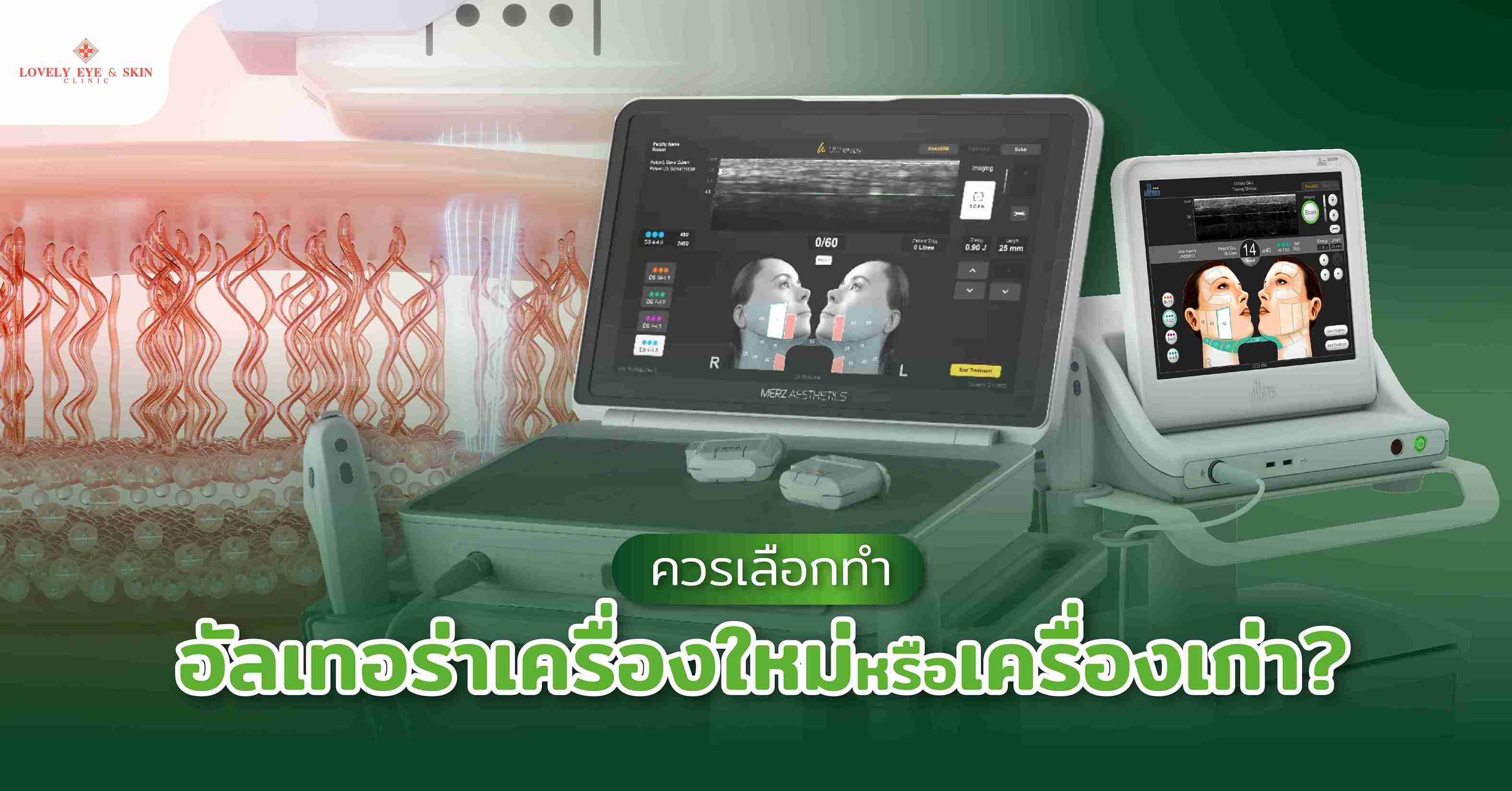 ควรเลือกทำอัลเทอร่าเครื่องใหม่หรือเครื่องเก่า?