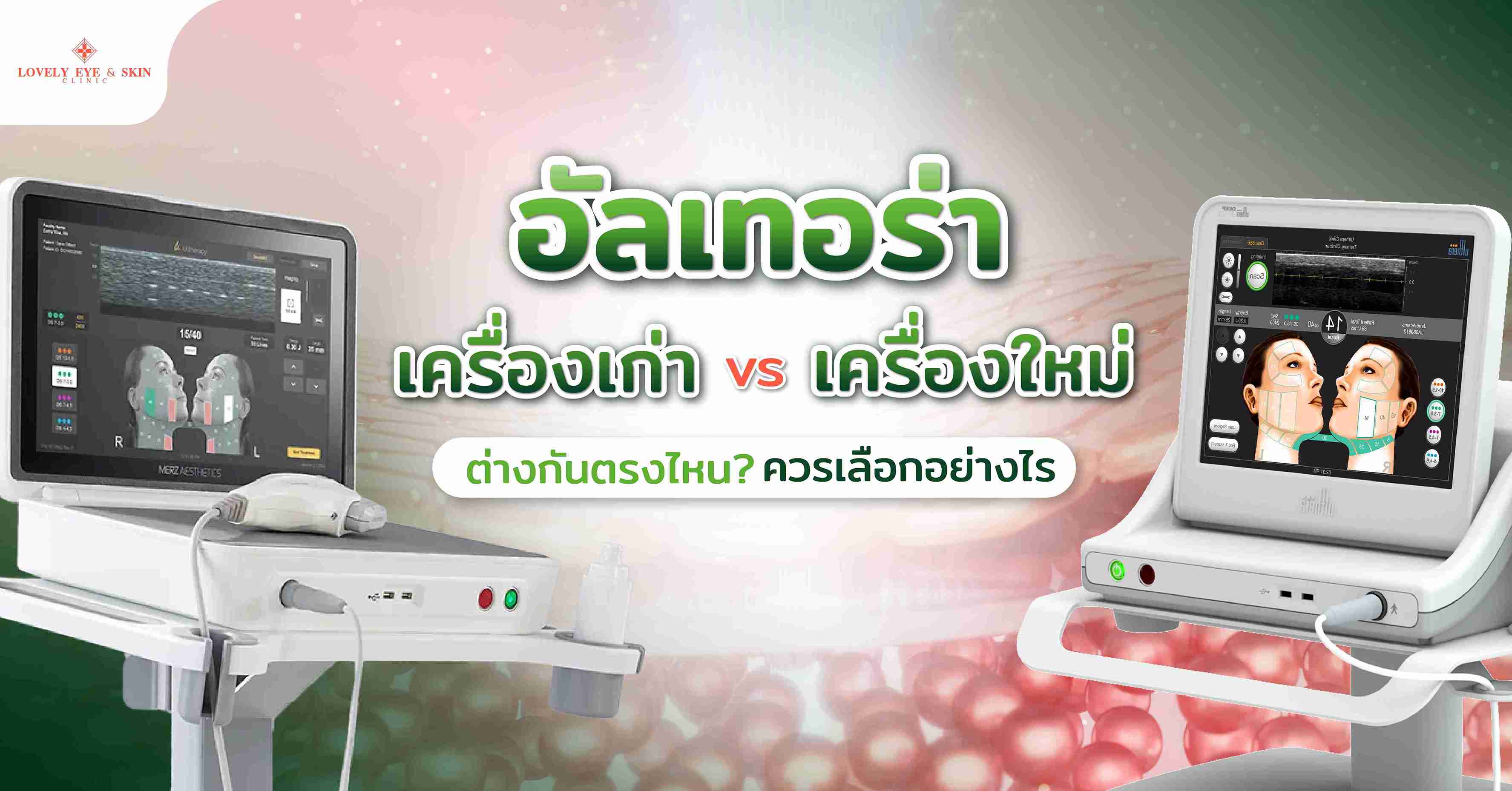 อัลเทอร่าเครื่องเก่า vs เครื่องใหม่ ต่างกันตรงไหน? ควรเลือกอย่างไร