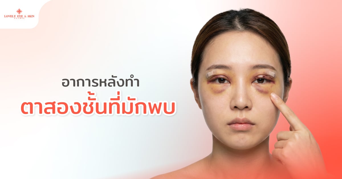 อาการหลังทำตาสองชั้นที่มักพบ