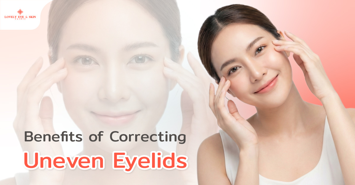 Benefits of Correcting Uneven Eyelids