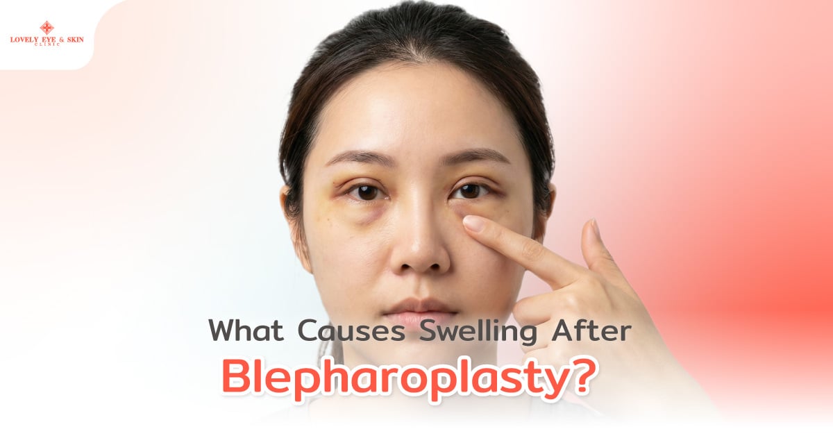 What Causes Swelling After Blepharoplasty?