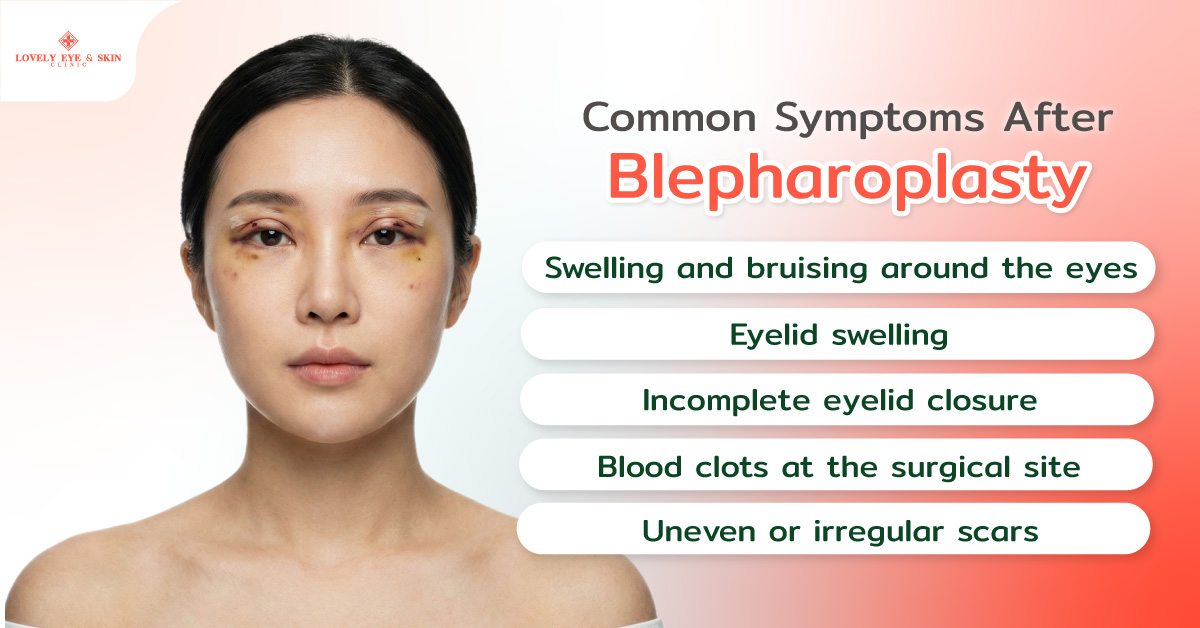 Common Symptoms After Blepharoplasty