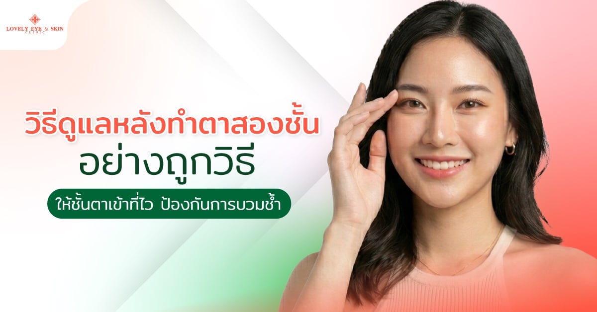 วิธีดูแลหลังทำตาสองชั้นอย่างถูกวิธี ให้ชั้นตาเข้าที่ไว ป้องกันการบวมช้ำ