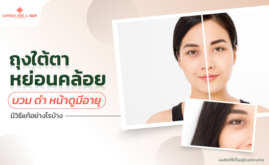 วิธีแก้ไขถุงใต้ตาหย่อนคล้อย บวม ดำ หน้าดูมีอายุ