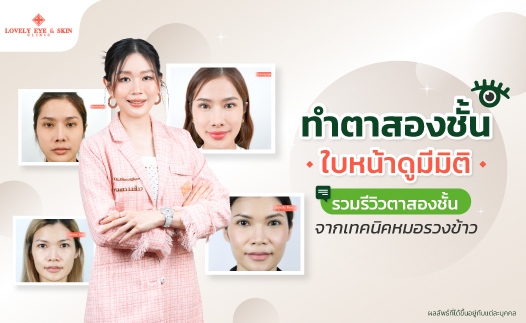 ทำตาสองชั้นใบหน้าดูมีมิติ รวมรีวิวตาสองชั้นจากเทคนิคหมอรวงข้าว