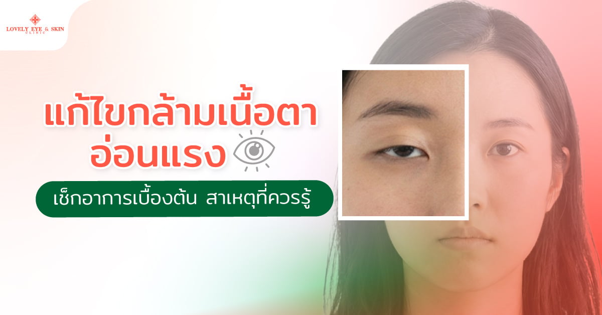 แก้ไขกล้ามเนื้อตาอ่อนแรงทำอย่างไร? เช็กอาการเบื้องต้น สาเหตุที่ควรรู้