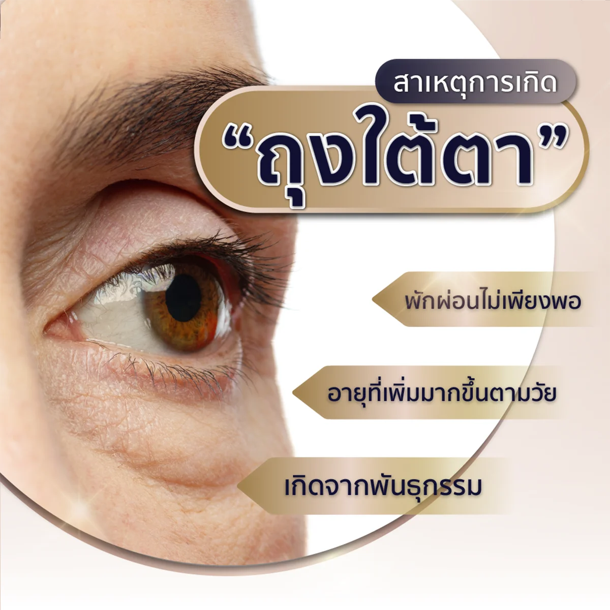 สาเหตุปัญหาถุงใต้ตาดำ