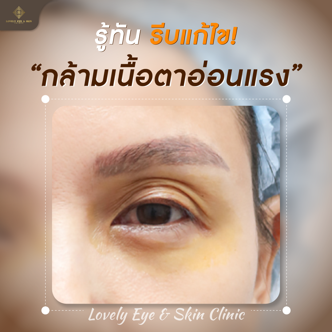 รู้ก่อนใคร กล้ามเนื้ออ่อนแรง 