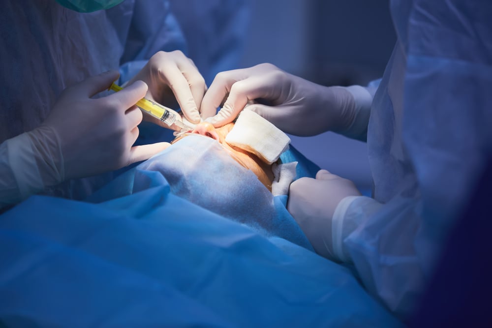  Eyes surgery