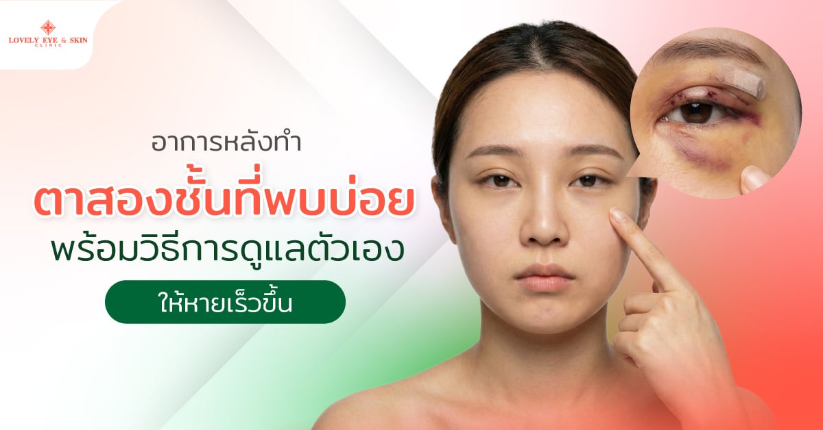 อาการหลังทำตาสองชั้นที่พบบ่อย พร้อมวิธีการดูแลตัวเองให้หายเร็วขึ้น
