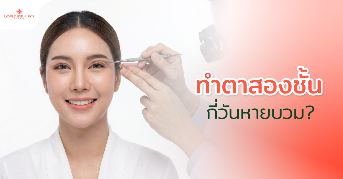ทำตาสองชั้นกี่วันหายบวม?