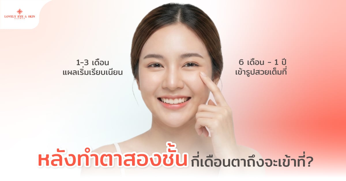 หลังทำตาสองชั้น กี่เดือนตาถึงจะเข้าที่?